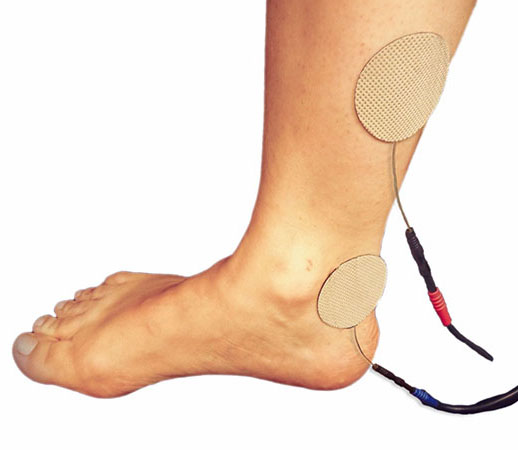 Jambe avec électrodes Urostim